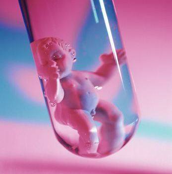 男性因素